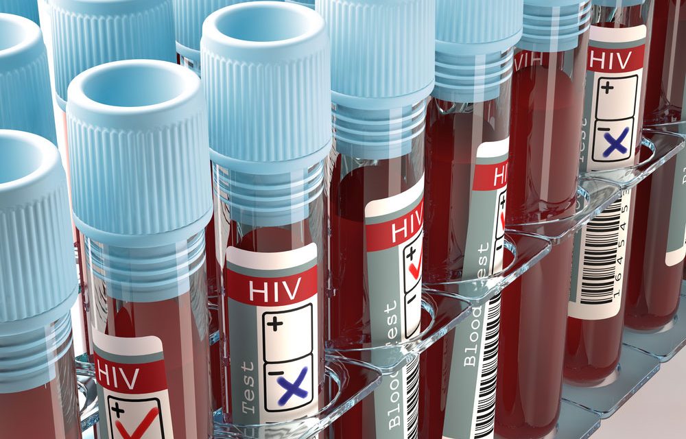 A promising new way to prevent HIV infections